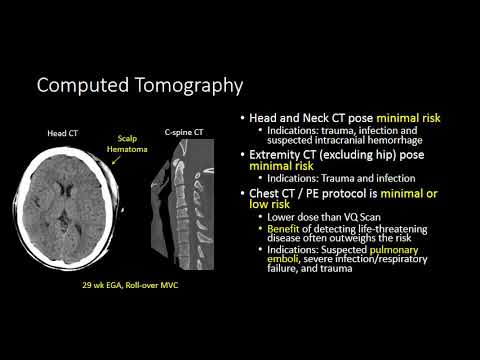 Advanced Imaging in Pregnancy