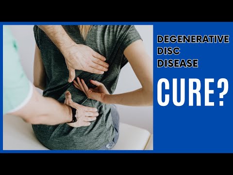 Can you Cure Degenerative Disc Disease?