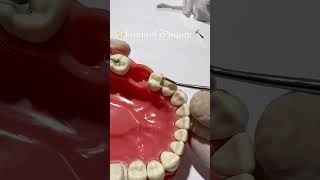 ✨ Enamel hatchet in action!Refining the proximal box | Dr.Dentique-hub