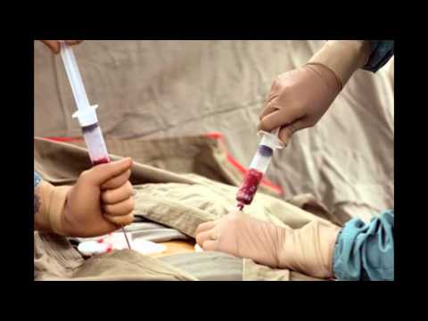Bone Marrow Transplant – An Expanding Demand in Medical Tourism