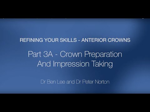 Anterior Crowns - Part 3: Crown Preparation and Impression Taking