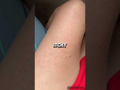 Itchy Skin? Try Aloe Vera This Way