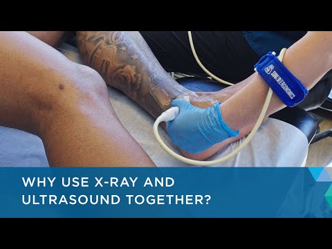 Why Use X-ray and Ultrasound Together?