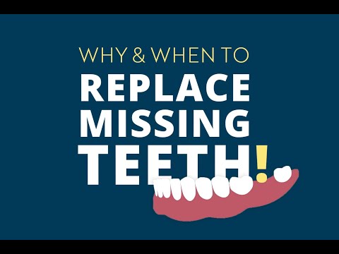 After An Extraction: Why & When to Replace Missing Teeth
