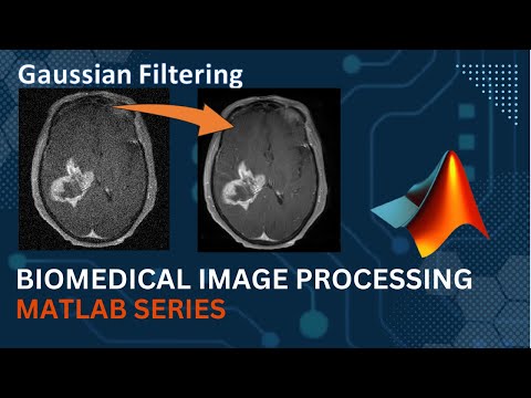 Gaussian Filter || MATLAB Code Implementation || Medical Image Processing | Computer Vision