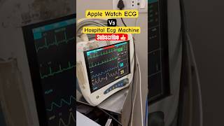 Apple Watch Series 9 ECG vs Real Hospital ECG | Accuracy Test & Comparison | #jaidmeel #apple
