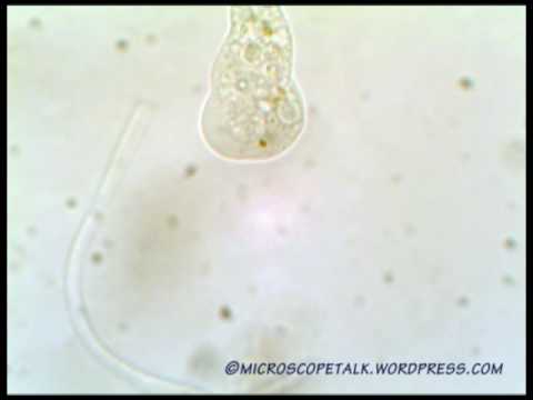 Amoeba in my pond life culture