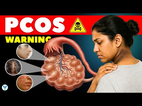 PCOS Early Signs You Can’t Afford to Ignore | Irregular Periods & Acne Explained