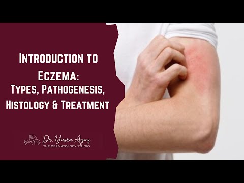 Lecture 1: Introduction to Eczema: Types, Pathogenesis, Histology & Treatment