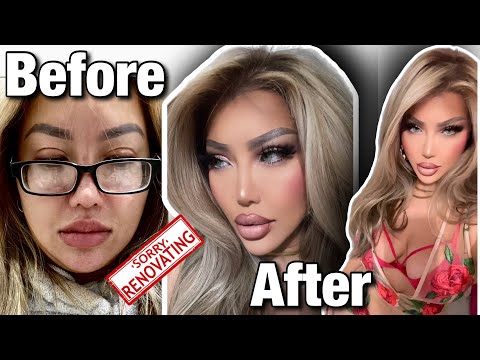 CATFISH MAKEOVER FOR 2023 | FILLER, BOTOX, RHINOPLASTY AND PDO THREADS
