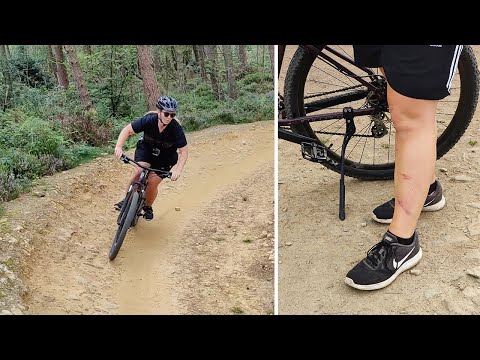 Crashed into a wooden stump at Lady Canning's MTB Trails