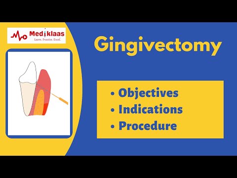 Gingivectomy l treatment of gingival overgrowth and gummy smile l Mediklaas