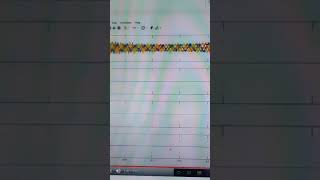 Stability Improvement of a Two-Area Power System Connected with an Integrated DFIG and STATCOM