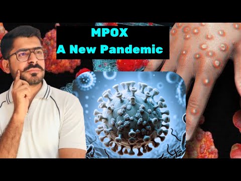 MPox || Threat alert for another pandemic; MonkeyPox || @abdulsaleem7264
