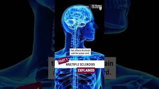 PT1: Multiple Sclerosis Explained: Here’s what you need to know about MS #multiplesclerosis #shorts