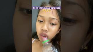 It hurts too 😅😂🤣 #biel #fypyoutube #subscribe