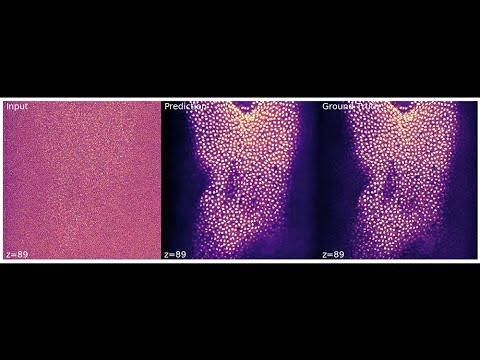 GVTNets Denoises Images & Reveals Otherwise Invisible Details