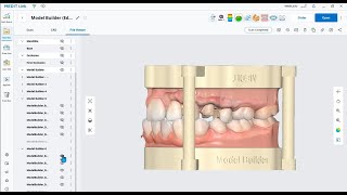 Samsun Vina I Medit Model Builder tạo mẫu hàm in 3D kỹ thuật số