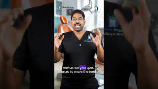 இன்விசலைனில் இப்படி உள்ளதா? - Greatest Advantage of Invisalign | Dr. Karthikeyan | Denta Kings