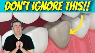What is a DEAD TOOTH and what to do about it