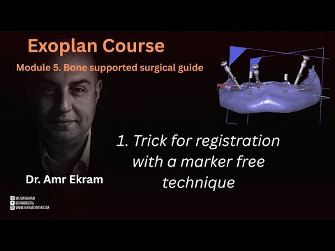 1  Trick for registration with a marker free technique