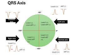 Simplified Pediatric ECG Interpretation