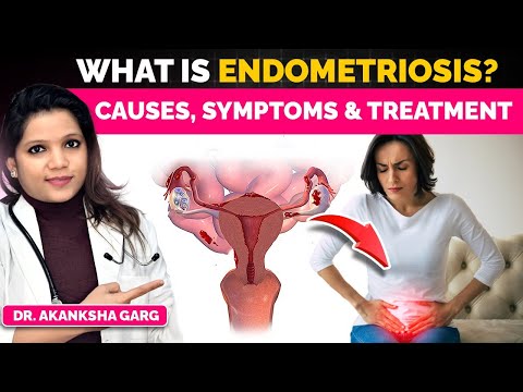 Endometriosis Kya Hota Hai? | It’s Symptoms, Causes & Treatment