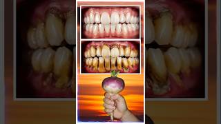 STOP STRIPS! 🛑 TURNIP Removes Tartar & Yellow Stains in 2 Mins! (Zero-Cost Hack) #Shorts #ViralTeeth