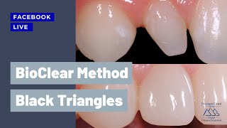 Questions answered about the Bioclear method | Réponses aux questions sur la méthode Bioclear