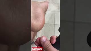 Dip Feet In Hydrogen Peroxide and see what happened #shortvideo #viralshorts #tipsandtricks
