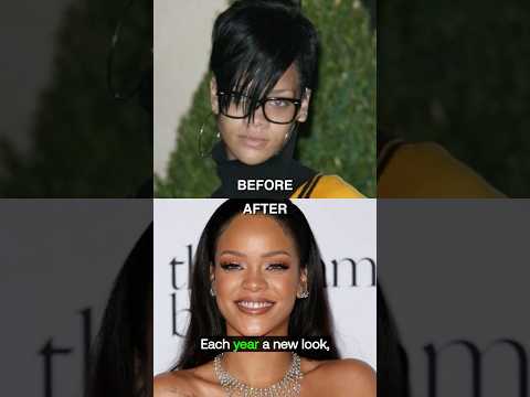 Rihanna’s Crazy Transformation 👀 From Pon de Replay to Powerhouse!