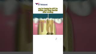 HTM Gutta Percha Points