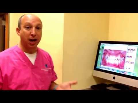 Orthodontic Photos: How We Take Orthodontic Photos at Nirenblatt Orthodontics