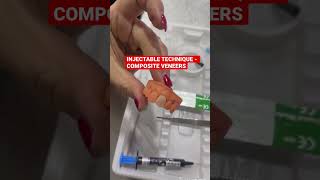 INJECTABLE TECHNIQUE - COMPOSITE VENEERS