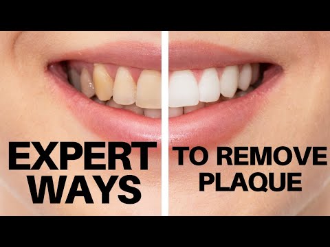 how to remove plaque from teeth | best ways to remove plaque