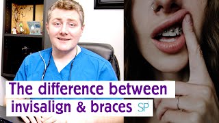 Invisalign FAQ - What's The Difference Between Invisalign and Braces?