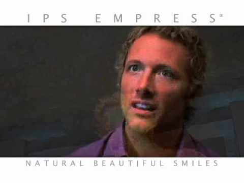 Empress Esthetic Porcelan Veneer - Empress Esthetic Crown from the Ceramics Dental Lab Miami