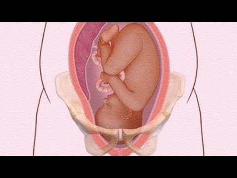 Types of Female Pelvis Explained | Essential Guide for Nurses, Midwives & Doctors