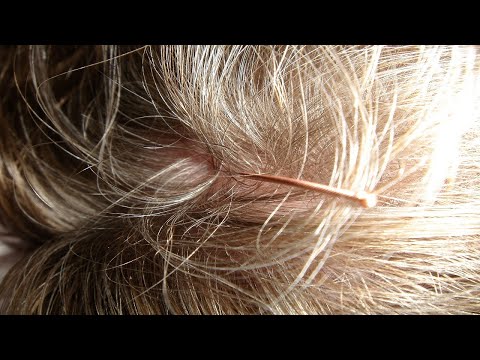 (2분 정보) 내 어깨에 쌓인 눈? 비듬의 원인과 관리방법