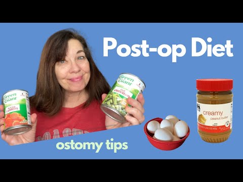 What Did I Eat Post Op | New Ostomate Diet | My Hospital Food Requests | Colectomy | Requested Video