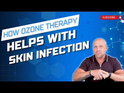 Ozone therapy for skin infections | Uses, benefits, side effects, and science