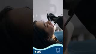 Other Alteratives to Braces | Faster teeth alignment | Teeth Alignment in Madurai Chennai