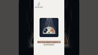 Hair Loss DOESN'T Wait — You SHOULDN'T Either.