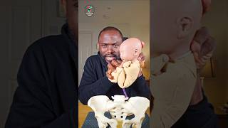 Complete Breech Presentation - Types of Breech #brainsforchange #inspiredtoinspire #viralvideo