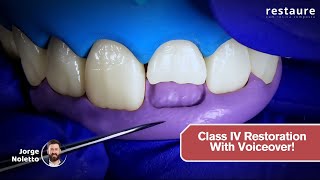 Anterior Composite Restoration Class IV | Step by Step with narration