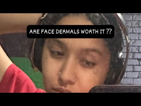 Are face dermals worth it ??