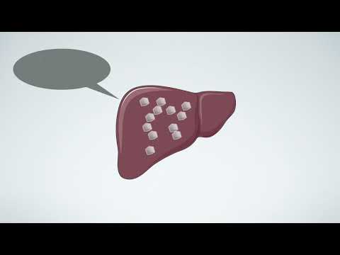 [Free Course] 05 02 Where Does Fat Go