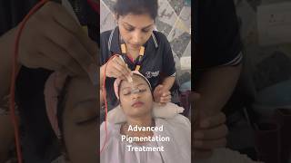 Advanced Hyper Pigmentation Treatment With Galvanic| #shorts #pigmentationsolution #pigmentation
