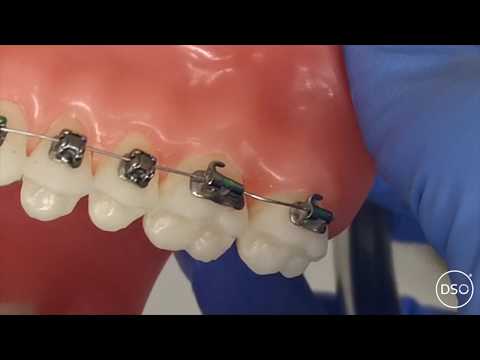 My wire has come out at the back! What can I do?