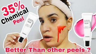 COSRX AHA BHA PHA LHA 35 Peel Review | Exfoliation for Smooth, Clear & Glowing Skin